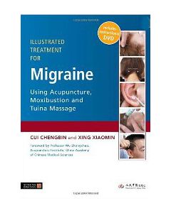 Illustrated Treatment for Migraine using Acupuncture, Moxibustion and Tuina Massage